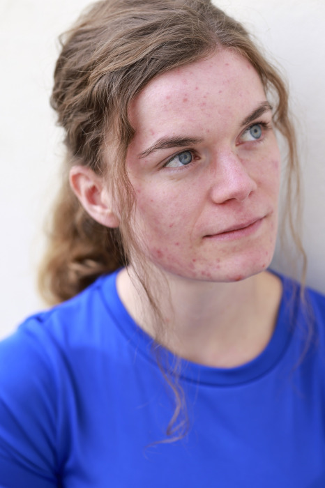 © Anja Hilverling 2025