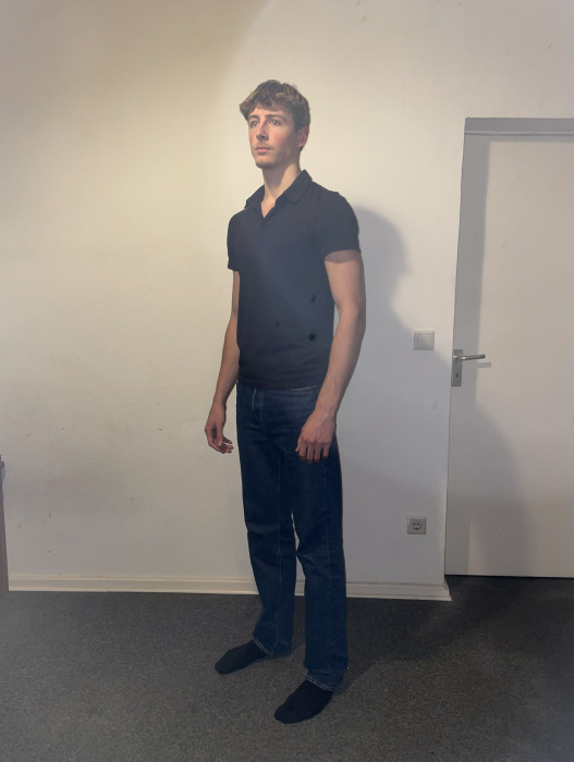 ©